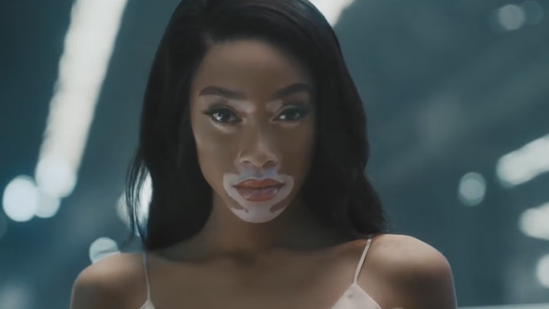 VW - Winnie Harlow