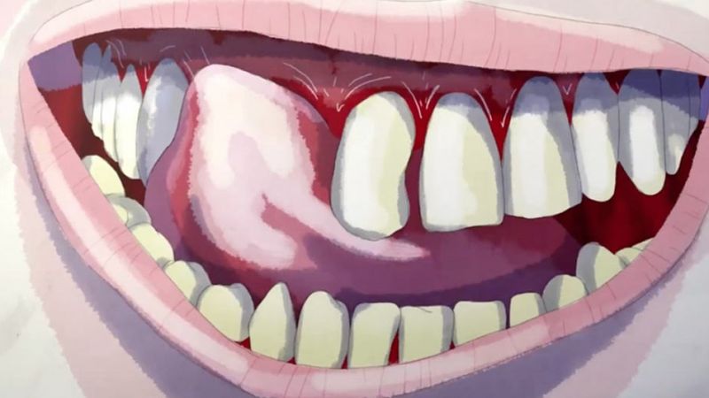 Teeth