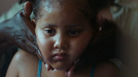 Vaseline’s tough love