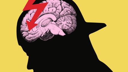 The disadvantaged creative brain