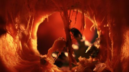 True blood: How a pumpkin conveyed the real horror of endometriosis